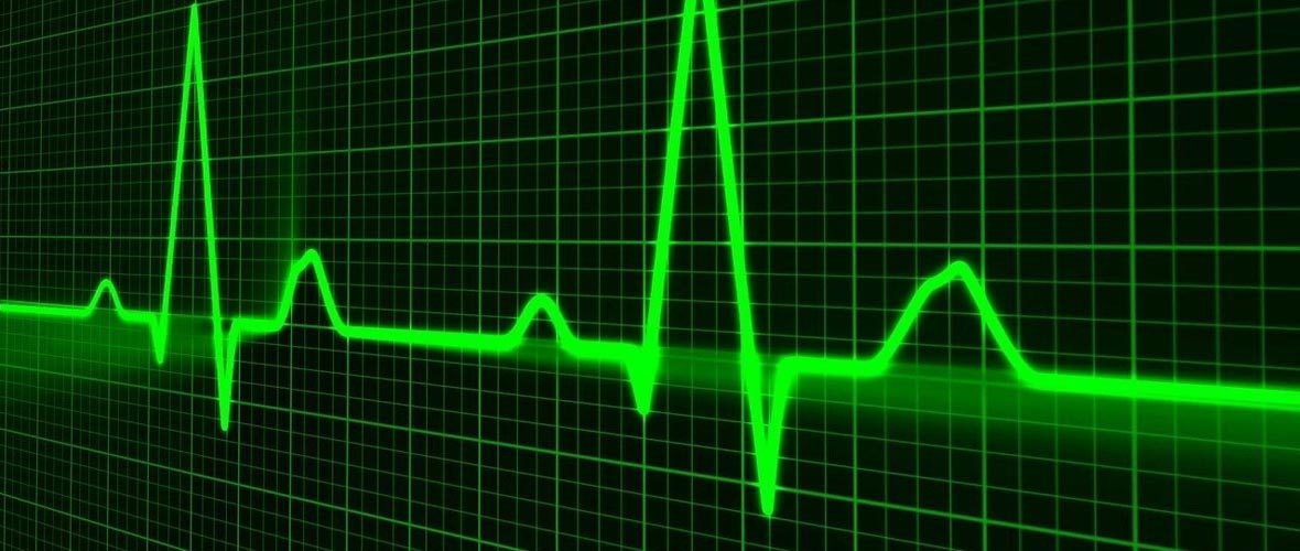Mulhouse, capitale de la cardiologie