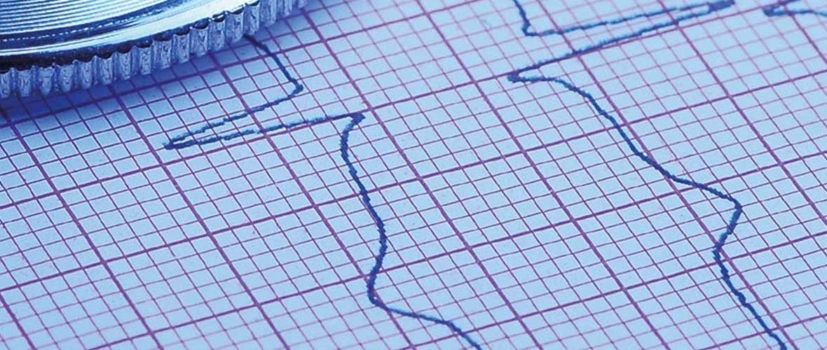 6e Congrès national de cardiologie dédié à “l’arrêt cardiaque subit“