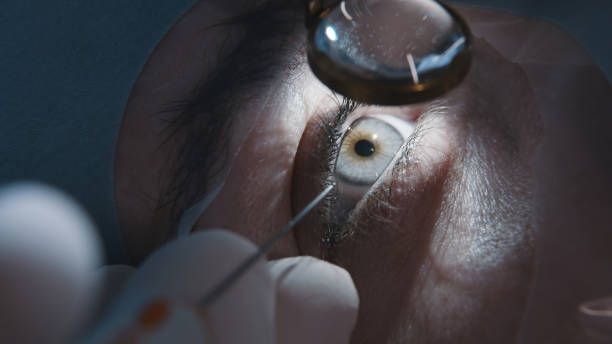 Dépistage des maladies de la vue liées à l'âge